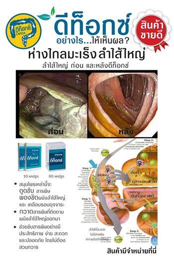 เอส เอ็ม แคปซูล เมล็ดบุชเชอร์รี่ รูบาร์บ ฝางเฟิง แคปซูลล้างลำไส้ 60 แคปซูล