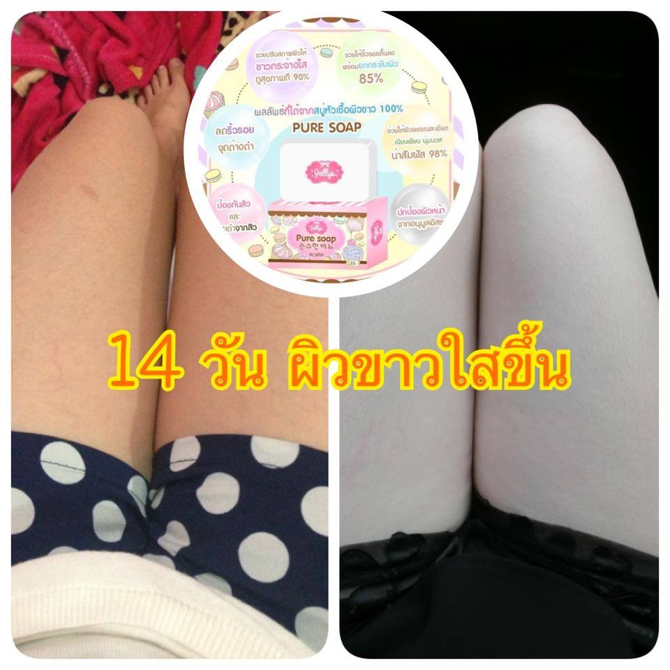 Pure Soap by jellys สบู่เจลลี่ หัวเชื้อผิวขาว100%