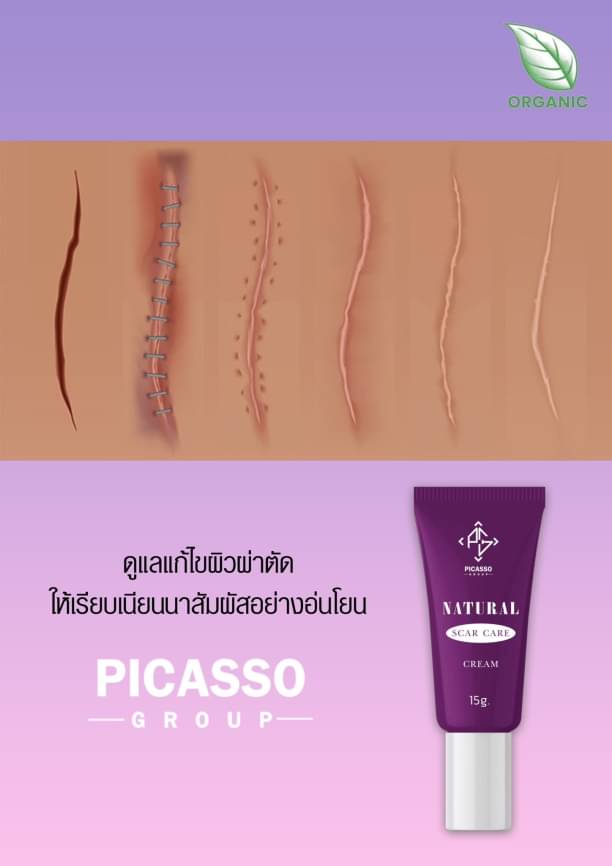 ทรีทเม้นท์ ดูแลรอยแผลเป็น 15g. ลดการอักเสบ บวม แดง