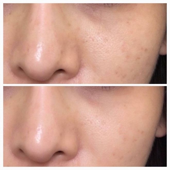 LumiSpa ลูมิสปา เครื่องล้างหน้าปั่นคอลลาเจน