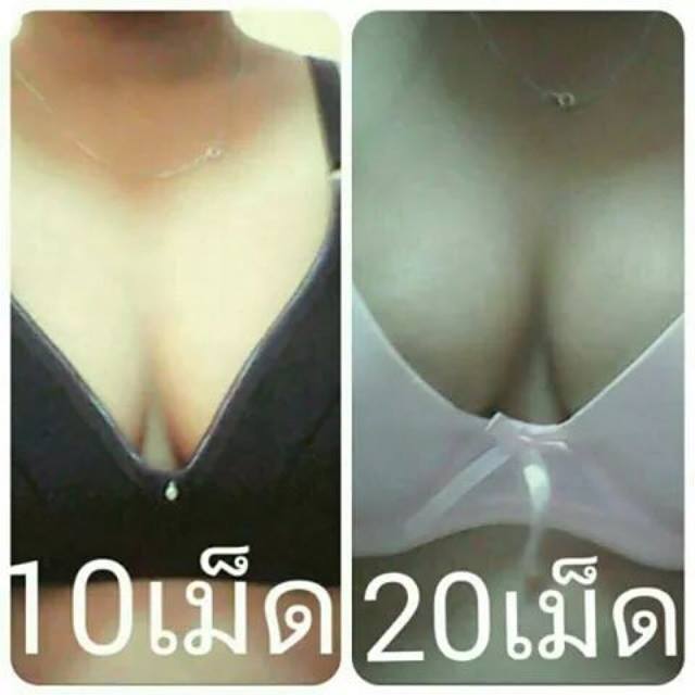 ยานมคลินิค ของแท้ เม็ด5บาท (แพ็ค20เม็ด)