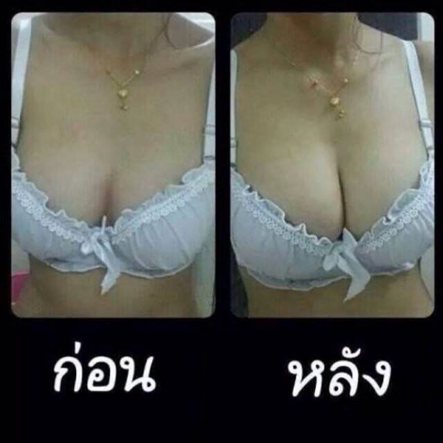 ยานมคลินิค ของแท้ เม็ด5บาท (แพ็ค20เม็ด)