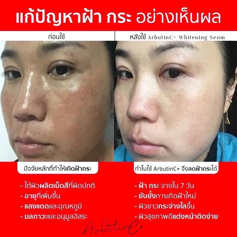เซรั่มอาบูตินซีพลัส Arbutin C+ ส่งฟรี