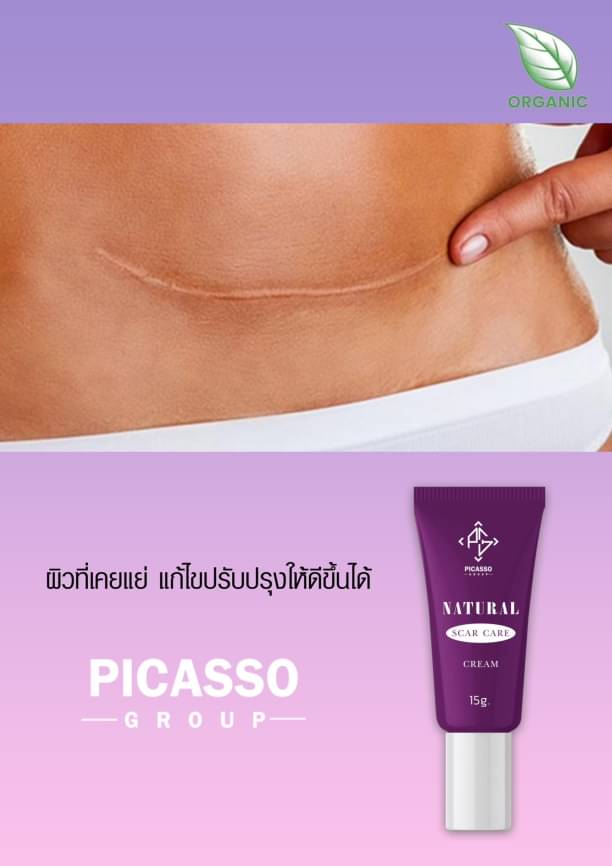 ทรีทเม้นท์ ดูแลรอยแผลเป็น 15g. ลดการอักเสบ บวม แดง