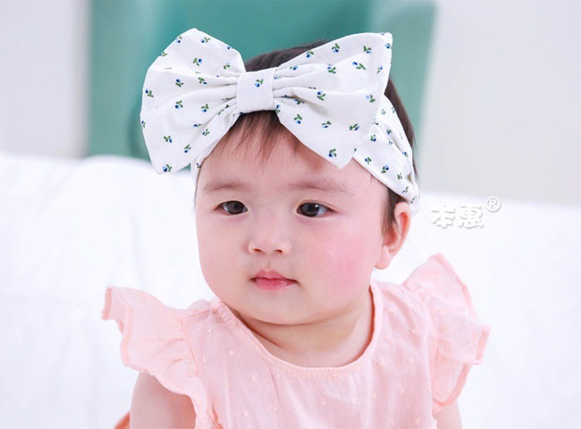 สายคาดผมโบว์ ลายเชอร์รี่