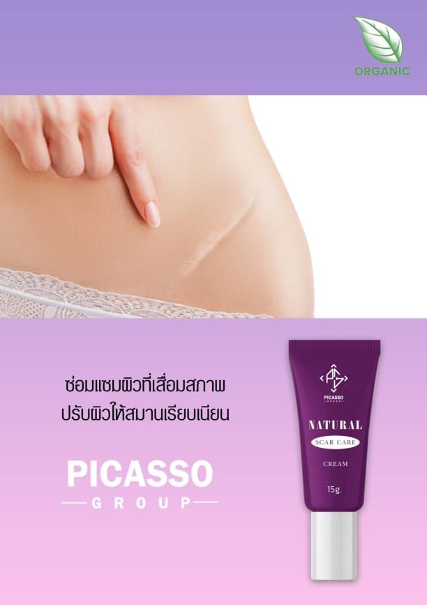 ทรีทเม้นท์ ดูแลรอยแผลเป็น 15g. ลดการอักเสบ บวม แดง