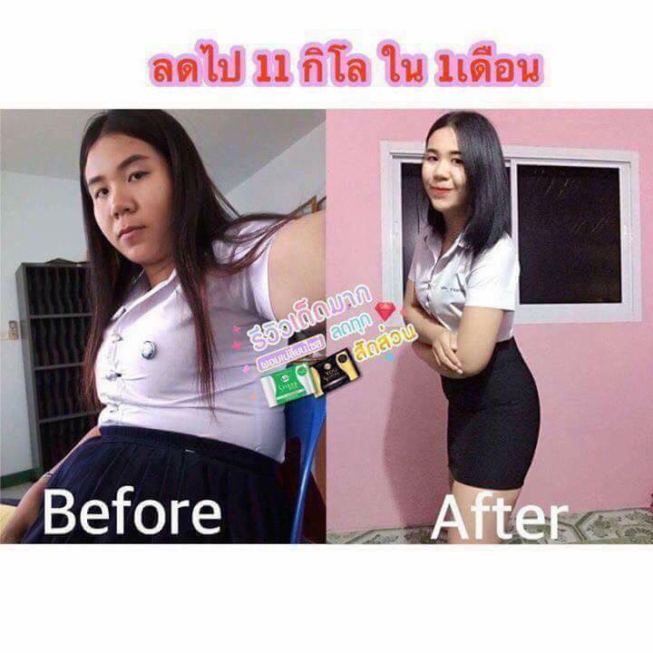 Sherb detox เอสเฮิร์บดีท็อกซ์
