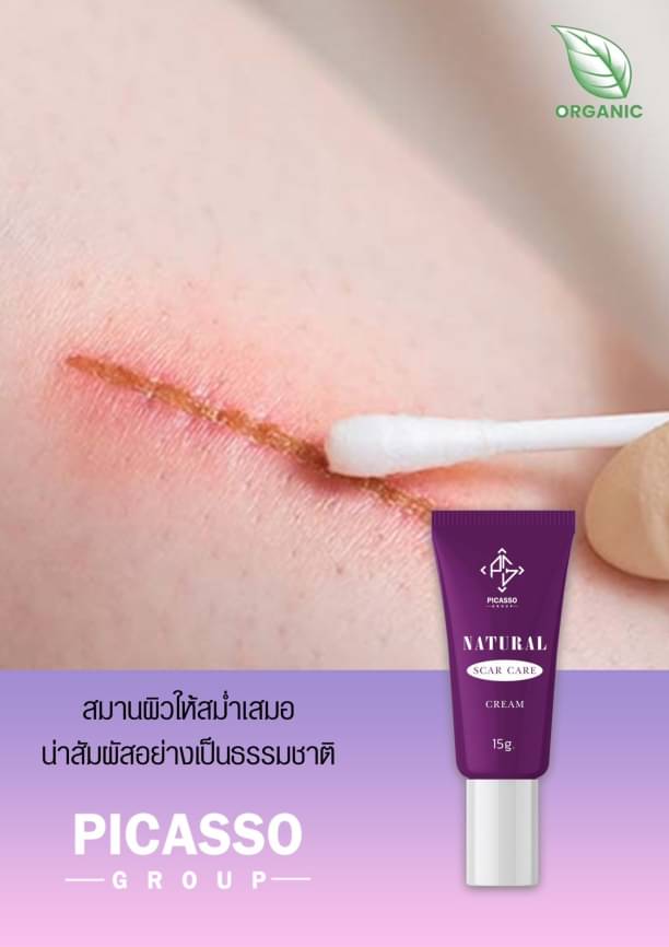 ทรีทเม้นท์ ดูแลรอยแผลเป็น 15g. ลดการอักเสบ บวม แดง