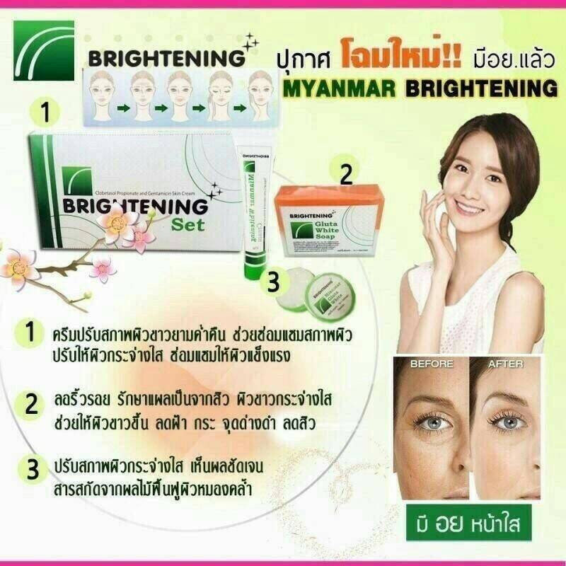 ชุดเซท ครีม พม่า (Set brightening mianmar)