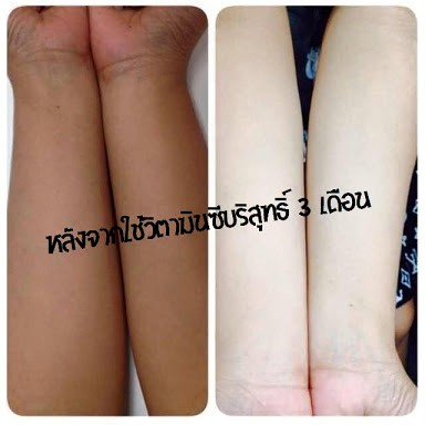 วิตซีกล่องเขียว V-C Injection