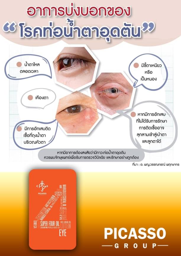 Super4 oil อาหารเสริมสำหรับดวงตา